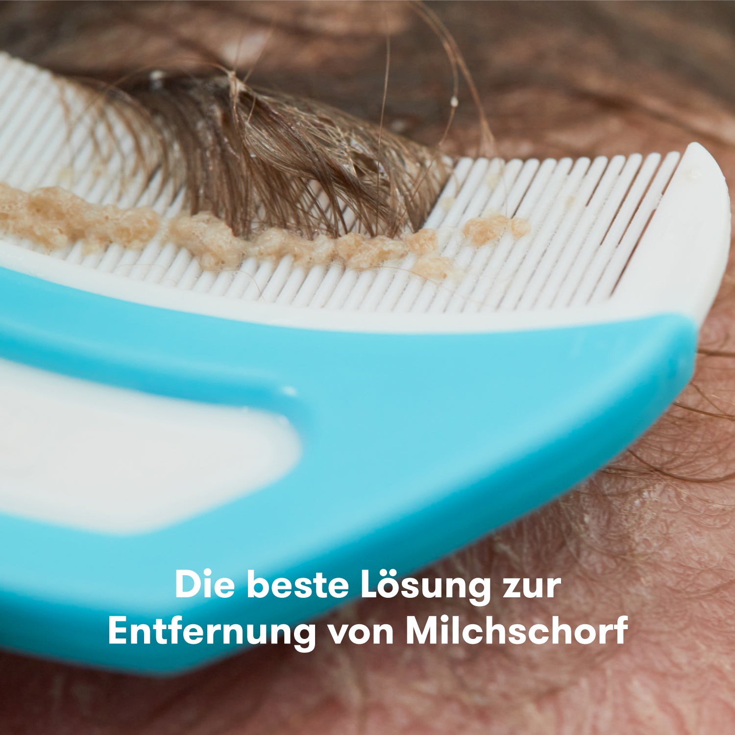 Flake Fixer 3-in-1 Milchschorf-Set: Milchschorf Kamm, Bürste und Schwamm